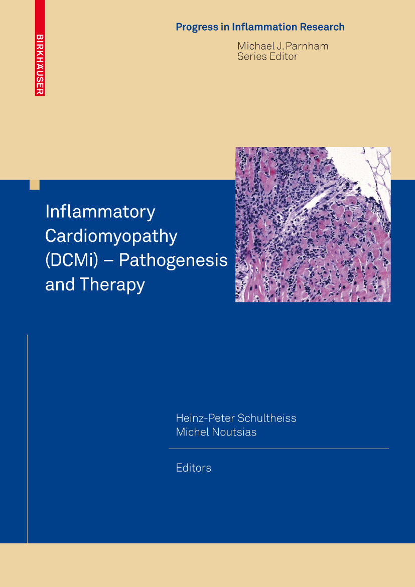 Inflammatory Cardiomyopathy (DCMi) - Pathogenesis and Therapy